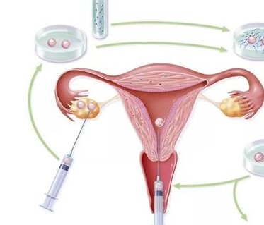 染色体异常不孕能在齐齐哈尔市第一医院做三代试管怀孩子吗？男人染色体有问题能做试管吗？