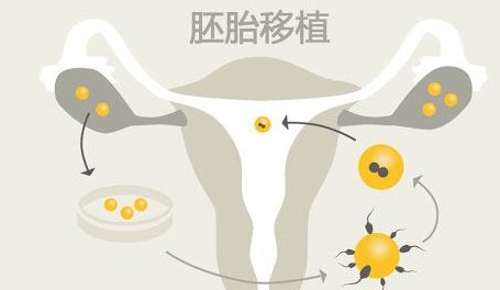 温州二院试管婴儿全流程价格公布，单次不成功成本更高